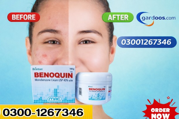 https://gardoos.com/product/benoquin-cream-price-in-pakistan/ 